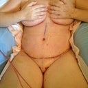 Day 6 Front Recliner - swollen?