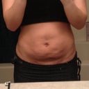 Post day 18