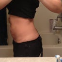 Post op day 18