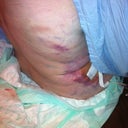 OMG Joe Pesci called and he wants his baseball ball bat that he used to work me over! Lipo was ridonkulous!!!