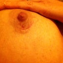 This is actually the scar that looked HORRIBLE in my earlier pics