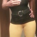 Clothing shot @6 weeks post op. Can fit into my clothes but still swollen