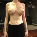 Day 3 post op
