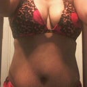 This is me now at 10 Mos PO. Pre-revision. Dr. Walker is going to shoot to get rid of all this extra fat and revise the scar so its hidden under this bathing suit.