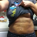 2 weeks post op