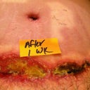 1st week after my incision opened.