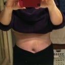 This is about 4 months later. Sorry I don't have too many to show as I'm not great at taking the pics. I went from a size 16 W before surgery (I was a 20-22 just a year before that) to a size 12 & some 10's now.