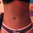 AFTER, look how flat it is now (POST-OP DAY #2)