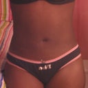 AFTER, beautiful!! (POST-OP DAY #2)