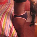 AFTER, no more back fat or protrusion of the belly (POST-OP DAY #2)