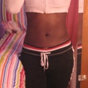 1 month POST-OP (about to work out, ready to kick some butt. Belly is really flat and smooth)