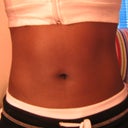 1 month POST-OP (Swelling seems gone to me)