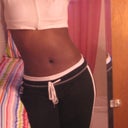 1 month POST-OP (me posing, I love to pose lol)