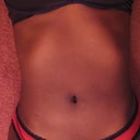 1 month POST-OP (laying down on my floor)