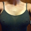 5 months post op