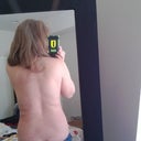 My back lipo. You can still see the incisions of course, and they are hard little lumps. I believe the lines you see there, are ripples from the lipo. I am guessing that will go away eventually. When I post my before photos you will see the huge difference. 5 weeks.
