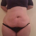 Front - Before