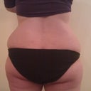 Back - Before