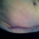 I hate this crease! I sure hope it goes away!!
