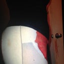 1 day post op!!