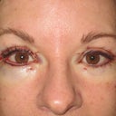 Immediately after - notice he spared my permanent eyeliner - yay