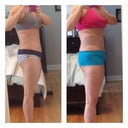 31 days on left side and 2 weeks on right. Finally seeing the swelling go down. YAY!