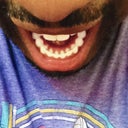 New PERMANENT bonding in the back of my teeth...