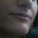 This was my lips 1 week after injection while still slightly swollen. They have gone down to original size by week two.