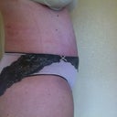 3 weeks, side view.  You can see that I'm still pretty swollen.