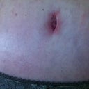 BB at 3 weeks.  Starting to heal finally!