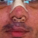 Five days after the OP