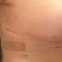 This incision is looking great