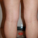 knees - before