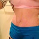 After! Yay! 6 days post op.