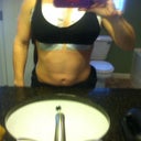 Post op day 1 LOTS OF SWELLING and riding high