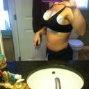 Post op day 1... Tried to get a side profile
