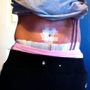 post op day 5