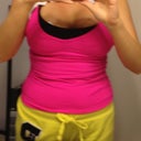 10 days post-op