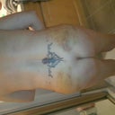 look at the bruising