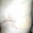 scar is looking good