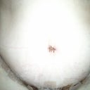 belly button