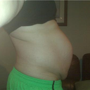 Pre-op Side (ew)
