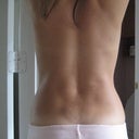 9 months post-op and 10 weeks pregnant