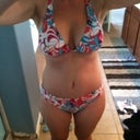 Full view - 3 weeks post op - right side still seems more swollen - you can see how uneven my sides are still - same as 2 weeks