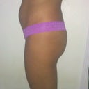 Sep 2012 Pre-op. Taking these pictures, me & hubby realized how flat my butt really is.
