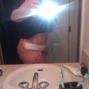 Same day I got home from surgery