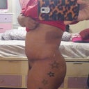 side view... 1 month post-op