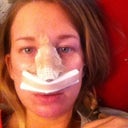 Day after surgery