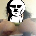 17 days post op. For those of you that missed it- I got high profile round gummy bear implants allergen inspira brand  , under muscle at 370cc. I was a b cup saggy c before and doctor removed 60 grams of fat from each boob to make me a full c. I'm going to go bra shopping in a couple months just to see what final size is after settling . So far I for c38