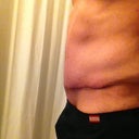 The scar looks darker red in the pictures than it does in real life.